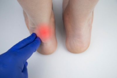 Achilles Tendonitis and Achilles Tendinosis